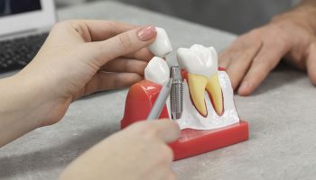 5 Signs You Might Need Dental Implants: Paoli Dentists Share